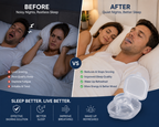 Premium Anti-Snoring Tongue Sleeve - Vault Deals