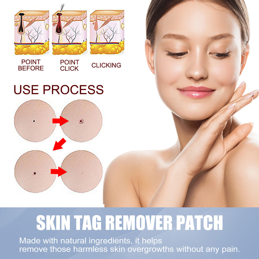 Invisible Acne Protection Patches - VAULT DEALS