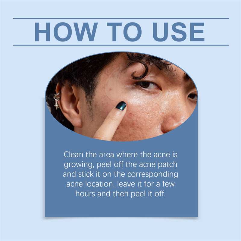 Hydrocolloid Acne Patches - VAULT DEALS