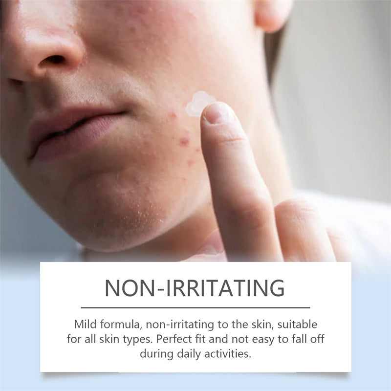 Hydrocolloid Acne Patches - VAULT DEALS