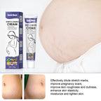 Stretch Marks Skin Repair Cream - VAULT DEALS