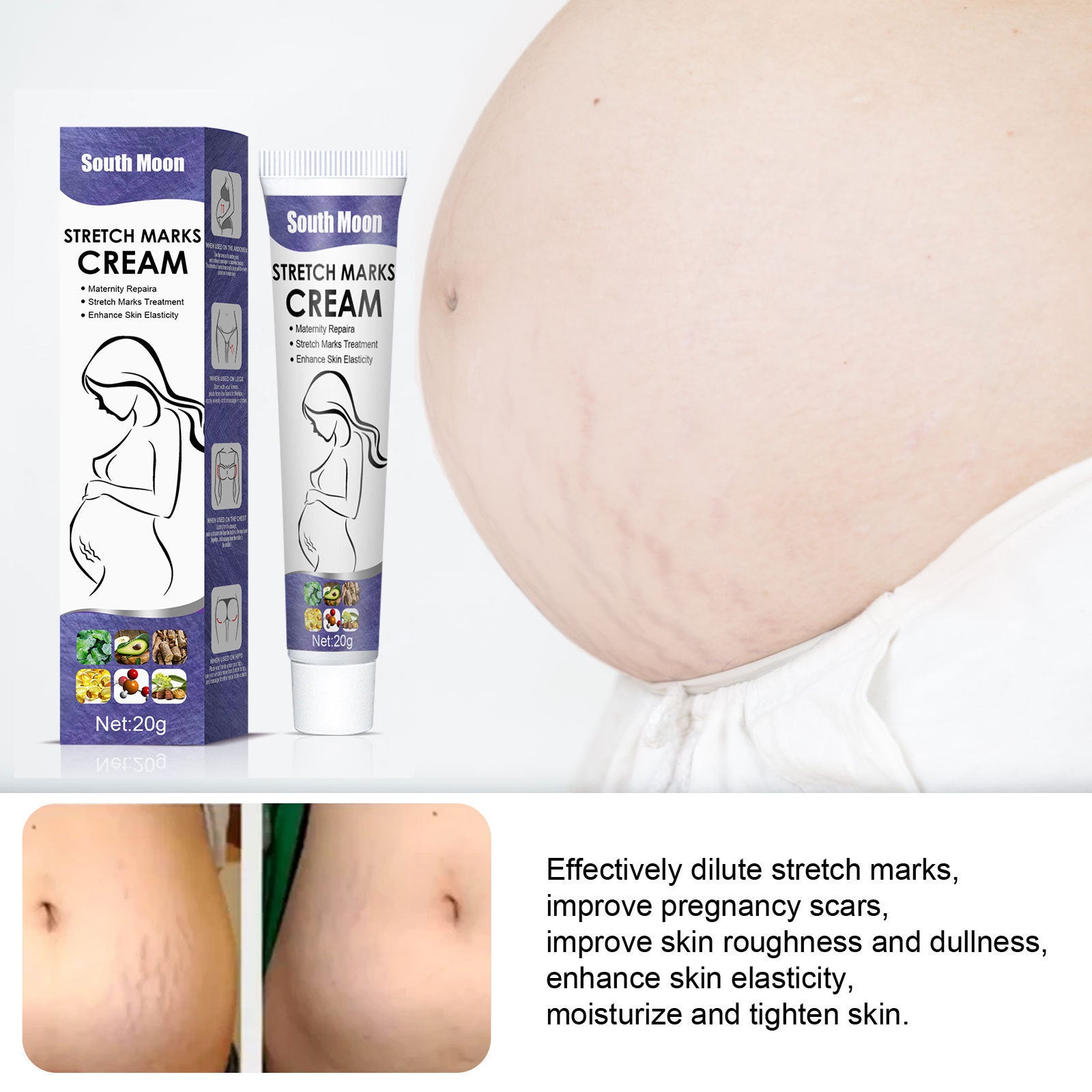 Stretch Marks Skin Repair Cream - VAULT DEALS